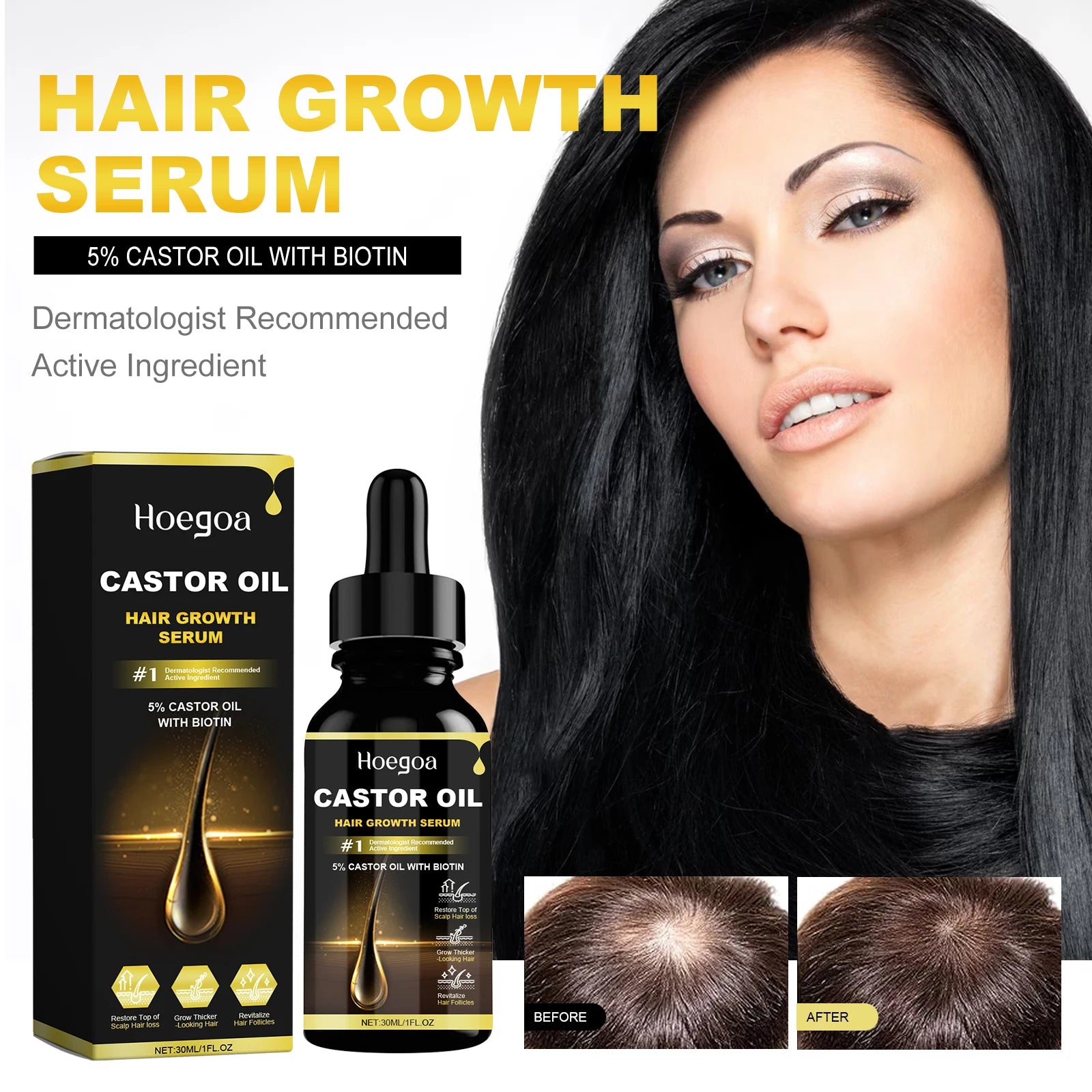 Hoegoa Castor Oil 30ml – Hair Growth & Thickening Essential Oil