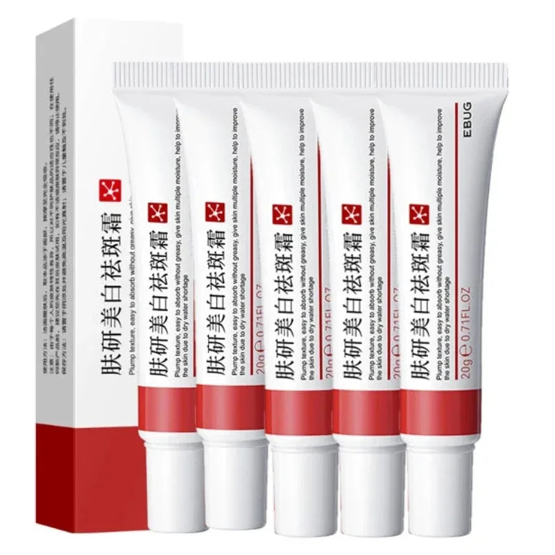 Whitening Freckle Cream – Dark Spot & Pigmentation Care