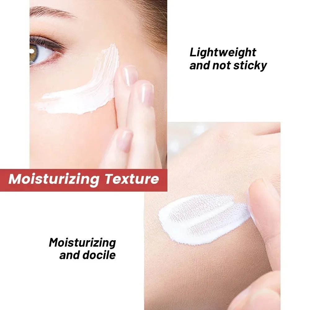 Whitening Freckle Cream – Dark Spot & Pigmentation Care