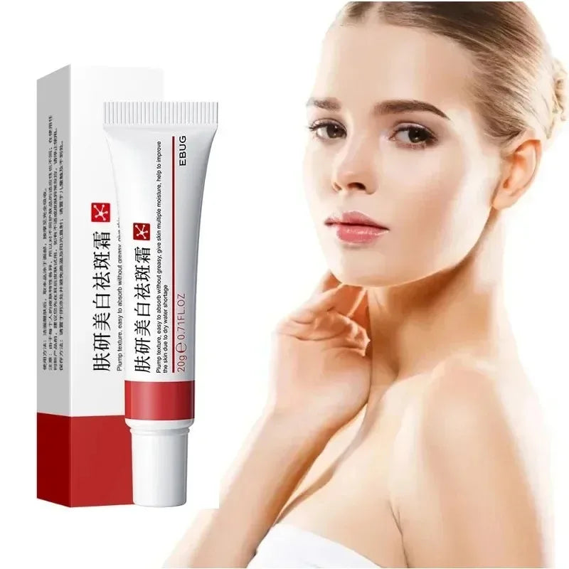 Whitening Freckle Cream – Dark Spot & Pigmentation Care