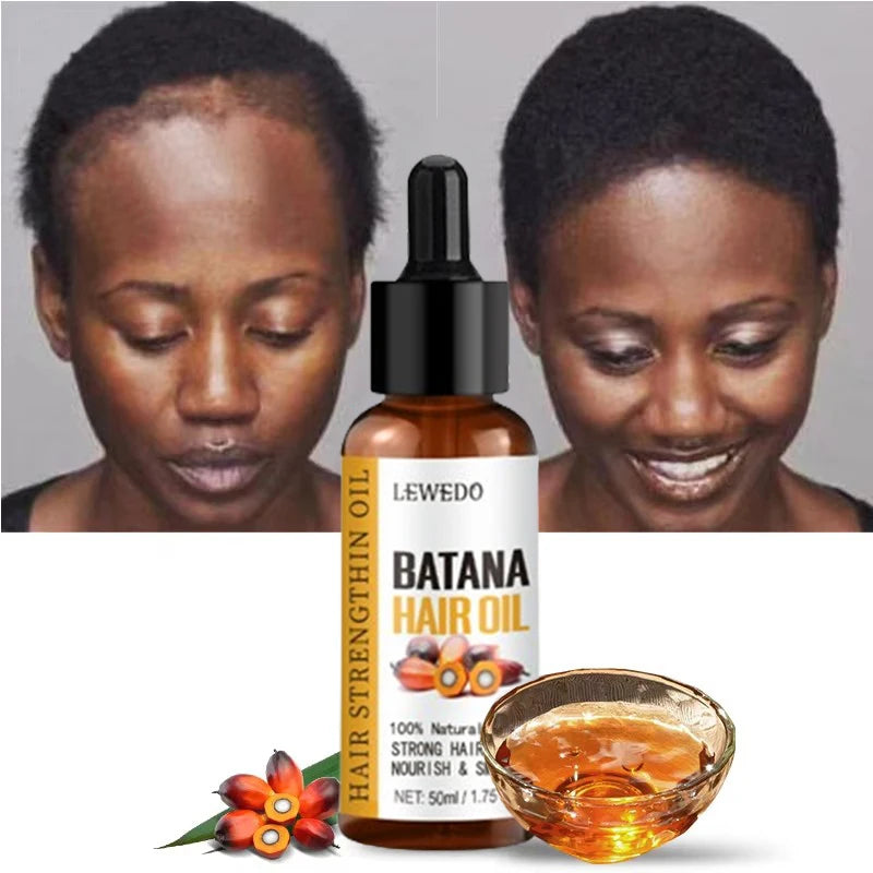 Lewedo Naturals Batana Oil – Fast Hair Growth & Anti Hair Loss