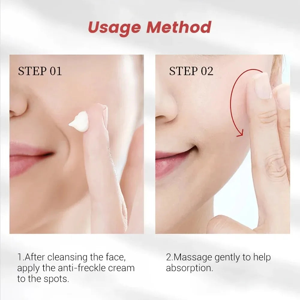 Whitening Freckle Cream – Dark Spot & Pigmentation Care