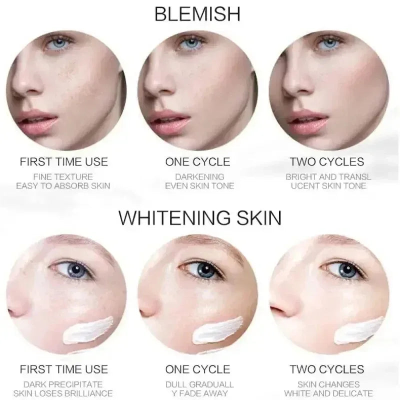 Whitening Freckle Cream – Dark Spot & Pigmentation Care